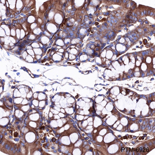 Anti-ROCK2 + ROCK1 Rabbit mAb