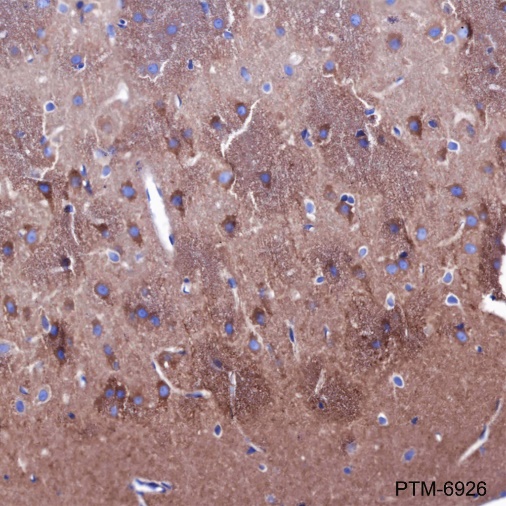 Anti-ROCK2 + ROCK1 Rabbit mAb