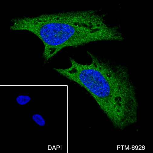 Anti-ROCK2 + ROCK1 Rabbit mAb