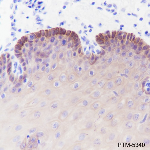 Anti-Keratin 16 Rabbit mAb