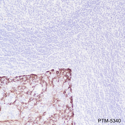 Anti-Keratin 16 Rabbit mAb
