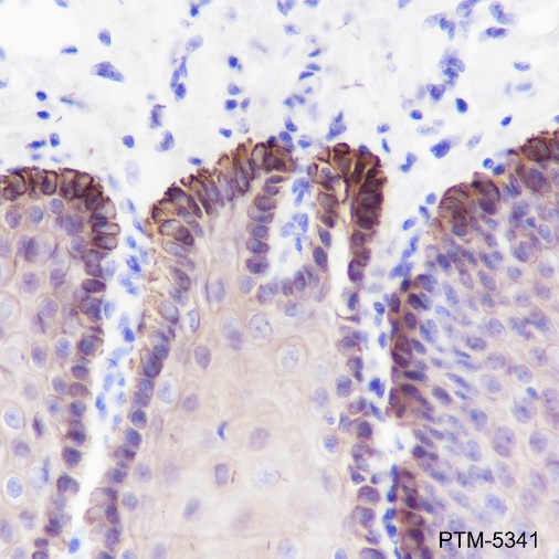 Anti-Keratin 16 Rabbit mAb