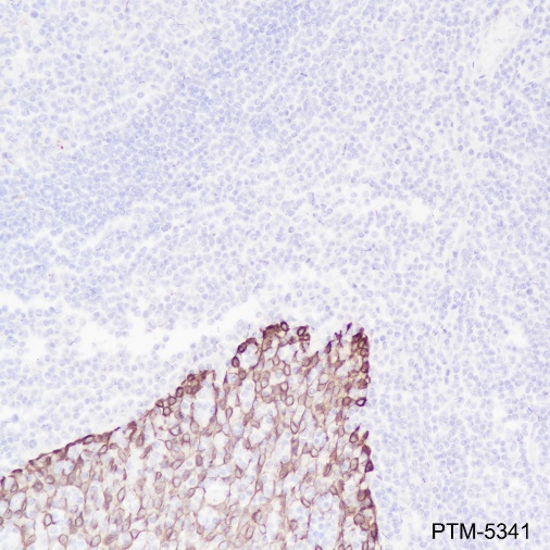 Anti-Keratin 16 Rabbit mAb
