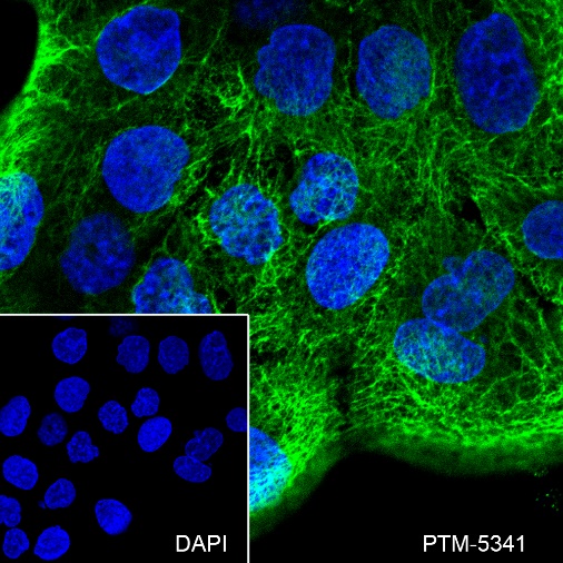 Anti-Keratin 16 Rabbit mAb