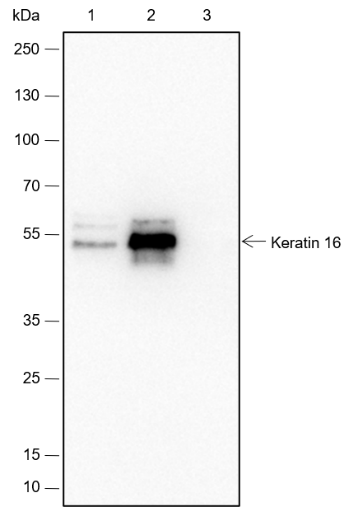 Anti-Keratin 16 Rabbit mAb