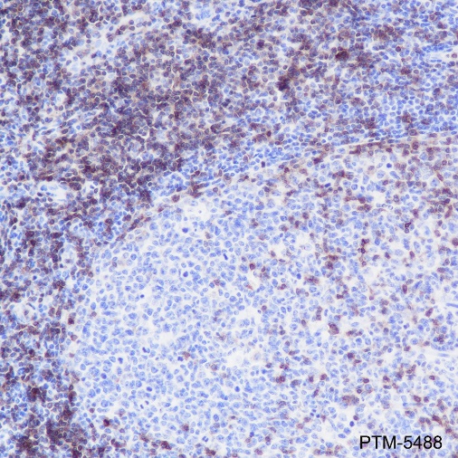Anti-CD3 gamma Rabbit mAb