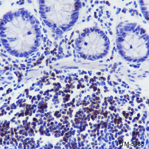 Anti-CD3 gamma Rabbit mAb