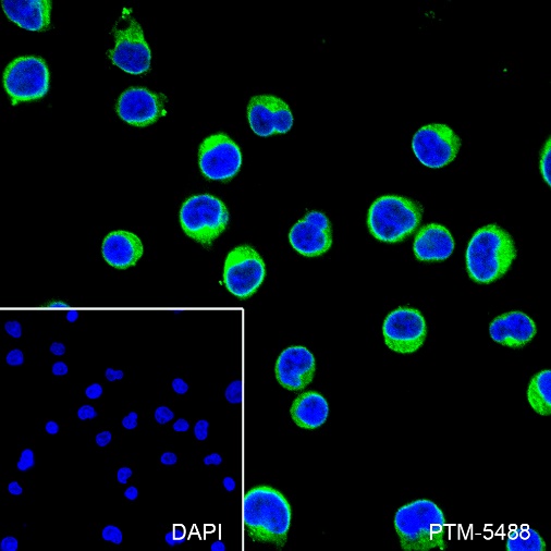 Anti-CD3 gamma Rabbit mAb