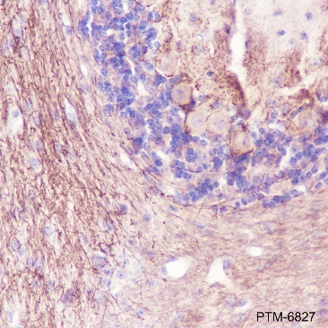 Anti-alpha-Internexin Rabbit pAb