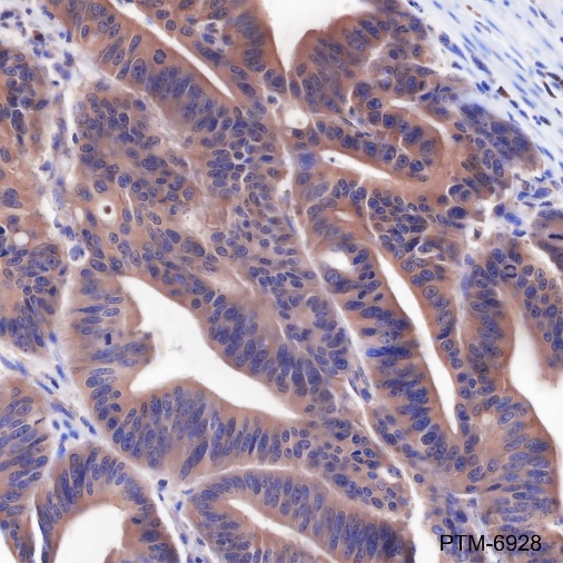 Anti-TRAF6 Rabbit mAb