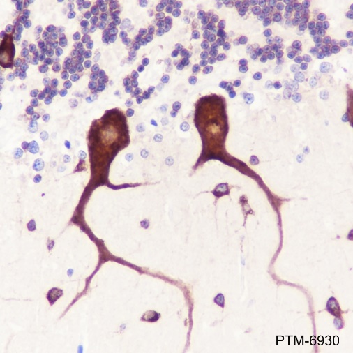 Anti-FARSB Mouse mAb