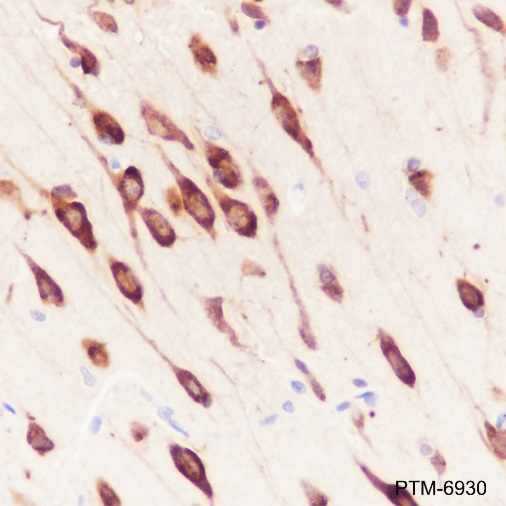 Anti-FARSB Mouse mAb