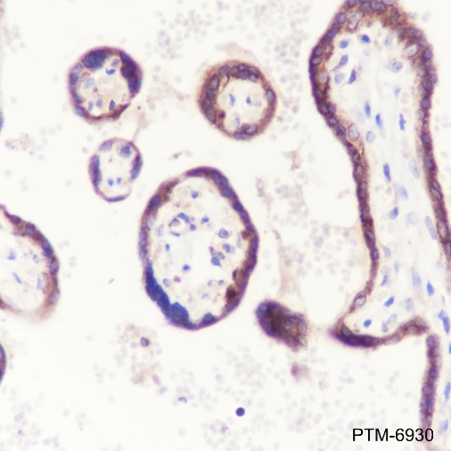 Anti-FARSB Mouse mAb