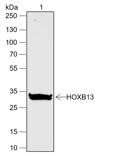 Anti-HOXB13 Rabbit mAb