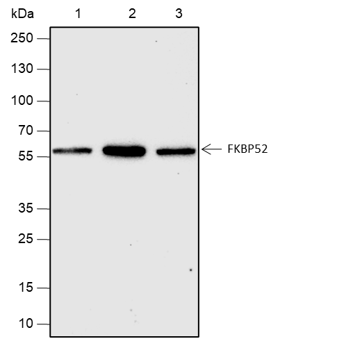 Anti-FKBP52 Rabbit mAb