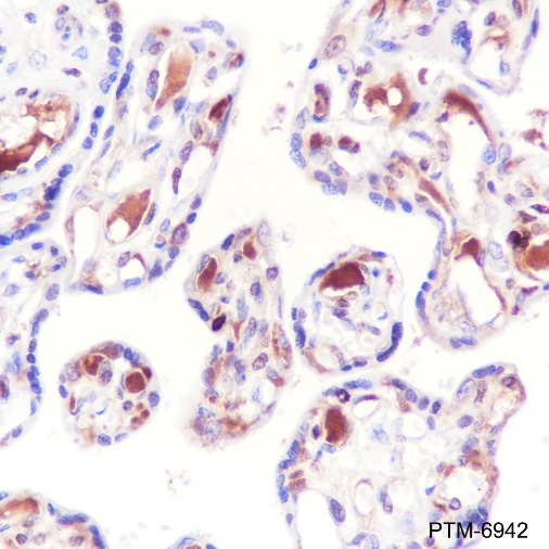 Anti-AACT Rabbit mAb