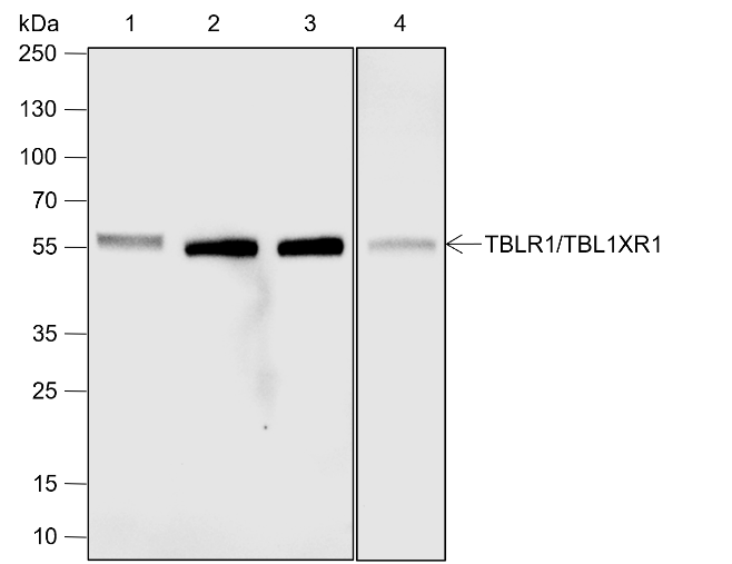Anti-TBLR1/TBL1XR1 Rabbit mAb