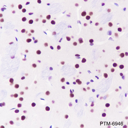 Anti-TBLR1/TBL1XR1 Rabbit mAb