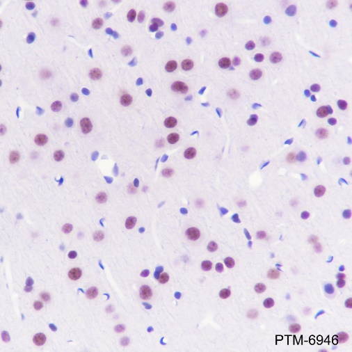 Anti-TBLR1/TBL1XR1 Rabbit mAb