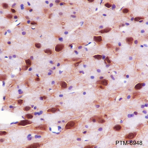 Anti-JNK2 Rabbit mAb