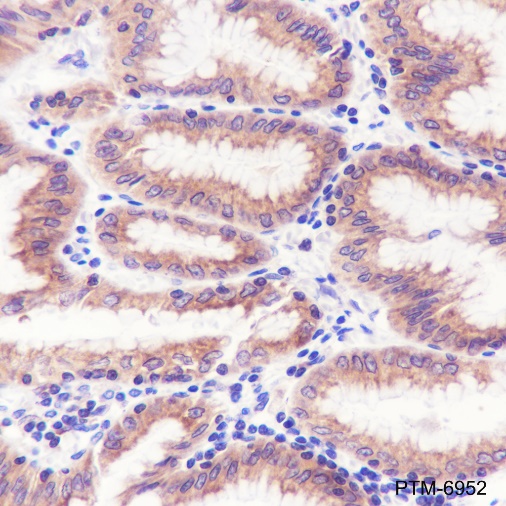 Anti-Rab8A Rabbit mAb