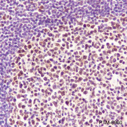 Anti-FEN1 Rabbit mAb