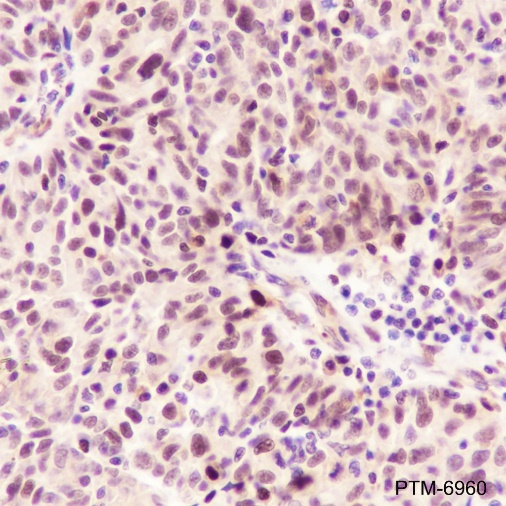 Anti-FEN1 Rabbit mAb