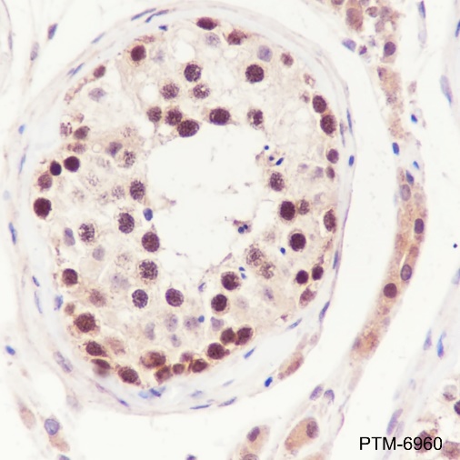 Anti-FEN1 Rabbit mAb