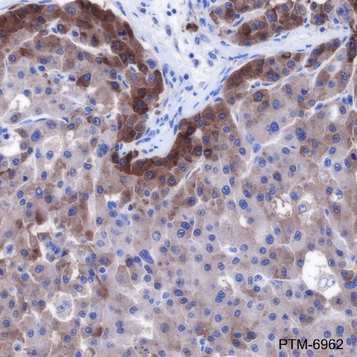 Anti-FGL1 Rabbit mAb