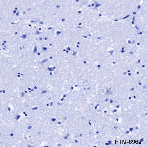 Anti-FGL1 Rabbit mAb