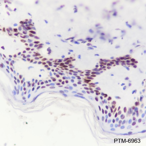 Anti-DDB2 Rabbit mAb