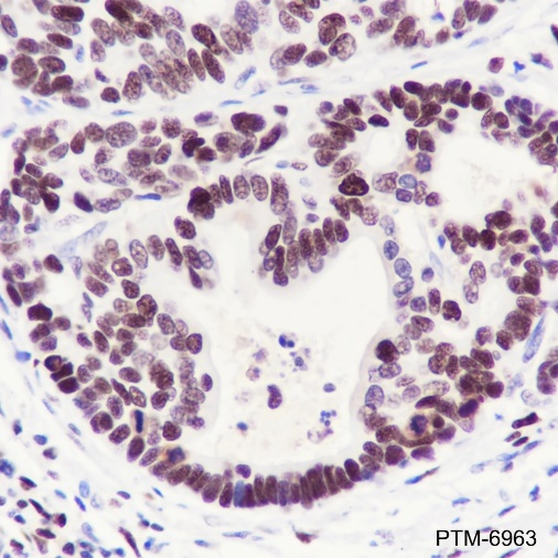 Anti-DDB2 Rabbit mAb