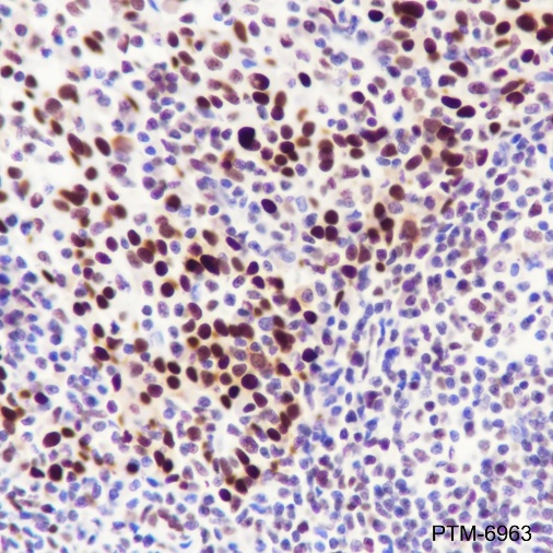 Anti-DDB2 Rabbit mAb