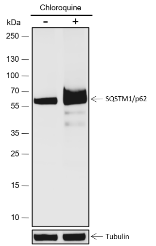 Anti-SQSTM1/p62 Rabbit mAb