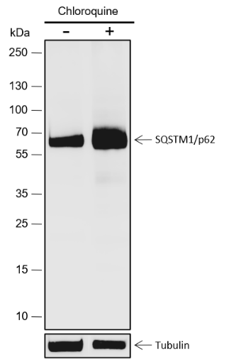 Anti-SQSTM1/p62 Rabbit mAb