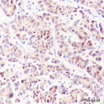 Anti-SQSTM1/p62 Rabbit mAb