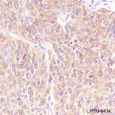 Anti-SQSTM1/p62 Rabbit mAb