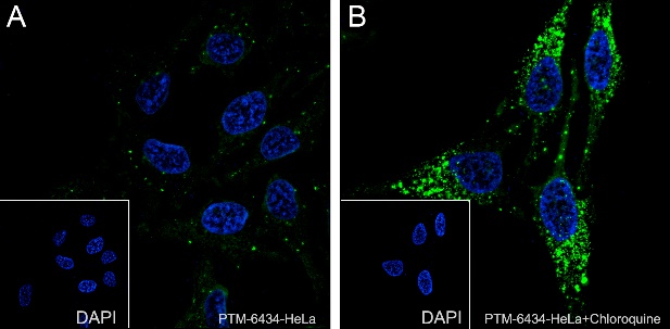 Anti-SQSTM1/p62 Rabbit mAb