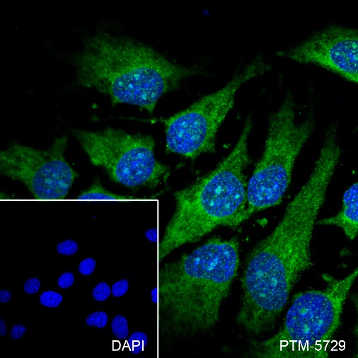 Anti-Cofilin-1 Rabbit mAb