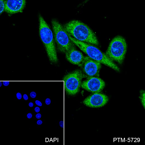 Anti-Cofilin-1 Rabbit mAb