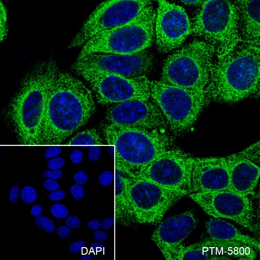 Anti-GRP94 Rabbit mAb