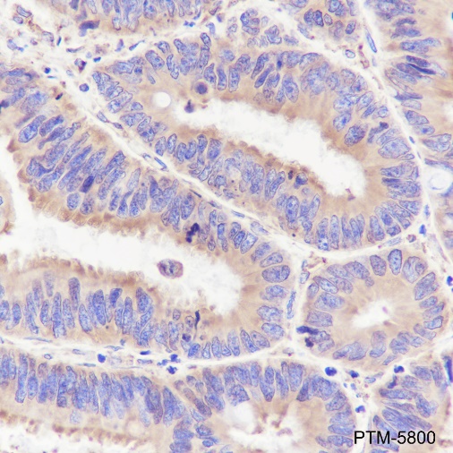 Anti-GRP94 Rabbit mAb