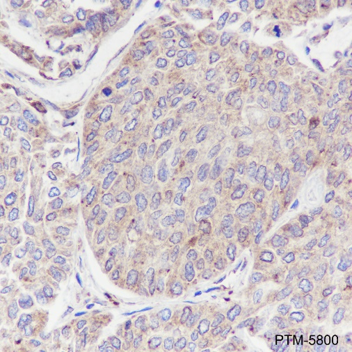 Anti-GRP94 Rabbit mAb