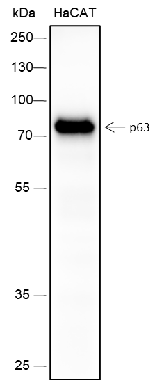 Anti-p63 Rabbit mAb