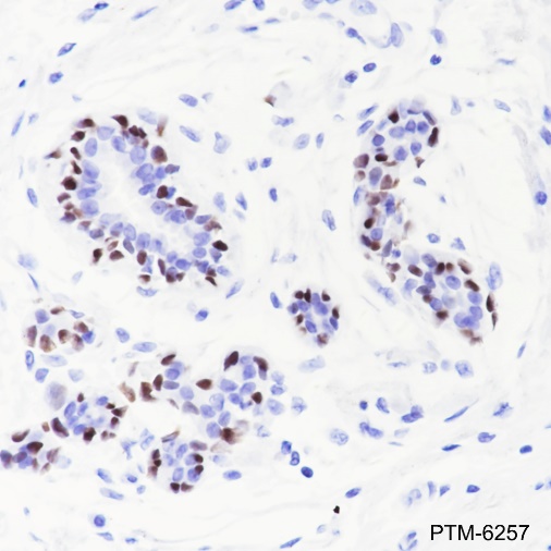 Anti-p63 Rabbit mAb
