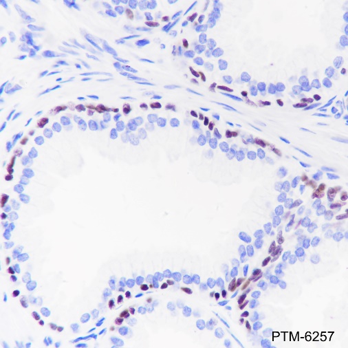 Anti-p63 Rabbit mAb