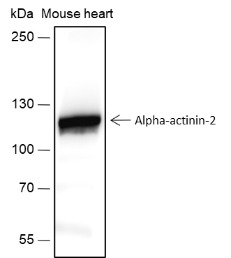 Anti-alpha Actinin 2 Rabbit mAb