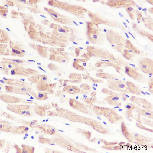 Anti-alpha Actinin 2 Rabbit mAb