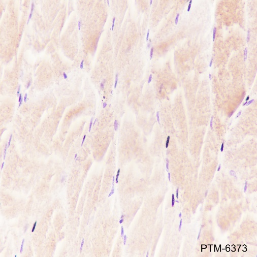 Anti-alpha Actinin 2 Rabbit mAb