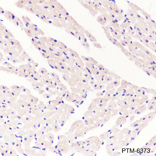 Anti-alpha Actinin 2 Rabbit mAb